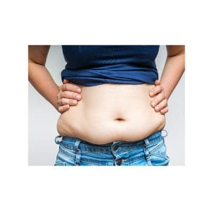 ایران سومین کشور در تولید علم جراحی چاقی