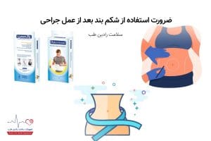 شکم بند بعد از عمل جراحی