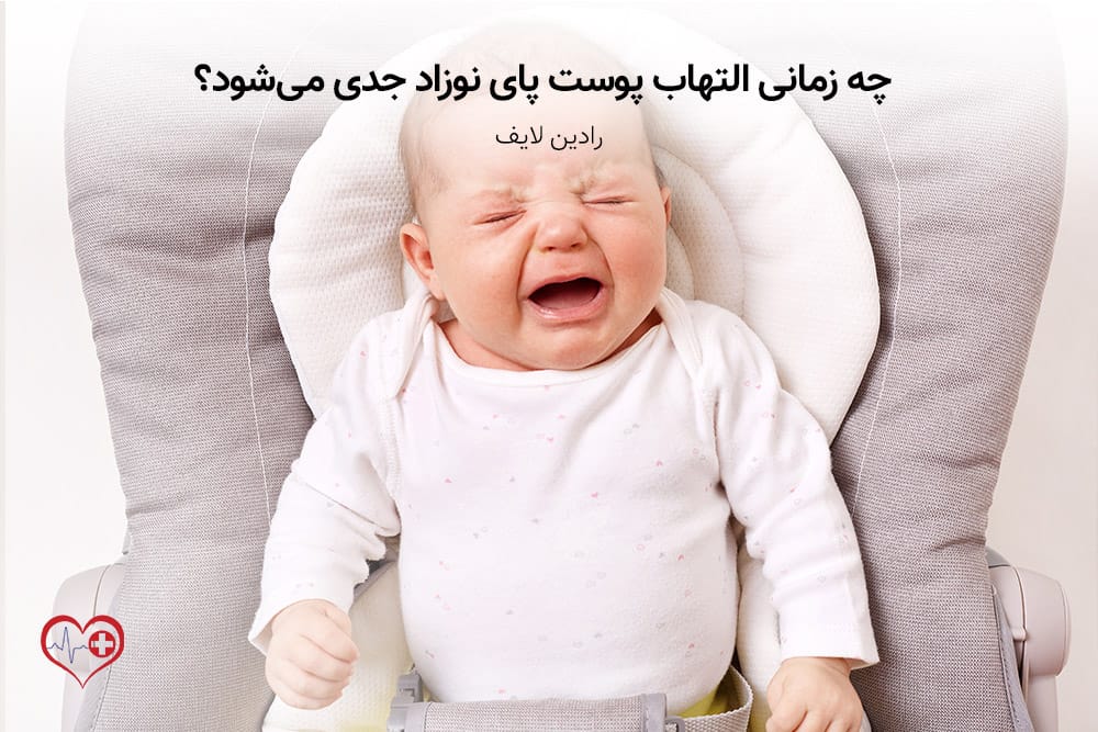 راهکارهای خانگی برای درمان ادرار سوختگی نوزادان 1 چه زمانی التهاب پوست پای نوزاد جدی میشود؟